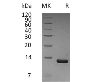 SDS-PAGE - Recombinant Human MCP2 Protein (6×His Tag) (A317587) - Antibodies.com