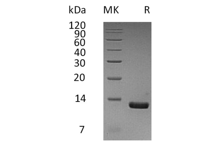 SDS-PAGE - Recombinant Human MCP2 Protein (6×His Tag) (A317587) - Antibodies.com