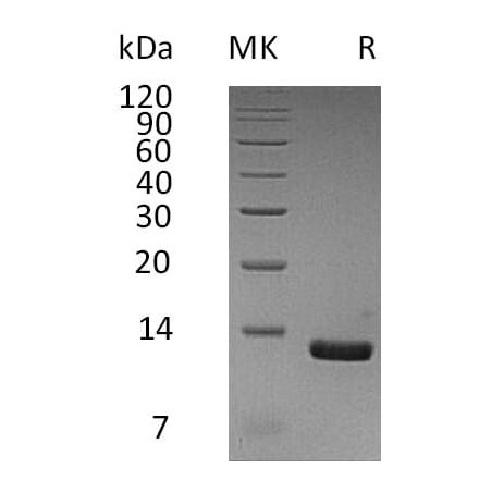 SDS-PAGE - Recombinant Human MCP2 Protein (6×His Tag) (A317587) - Antibodies.com