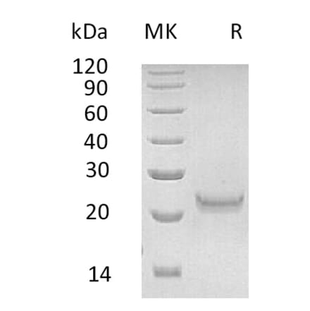 SDS-PAGE - Recombinant Human IFNW1 Protein (6×His Tag) (A317588) - Antibodies.com