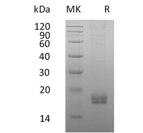 SDS-PAGE - Recombinant Human Eotaxin 2 Protein (6×His Tag) (A317589) - Antibodies.com