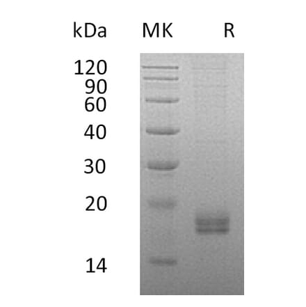 SDS-PAGE - Recombinant Human Eotaxin 2 Protein (6×His Tag) (A317589) - Antibodies.com