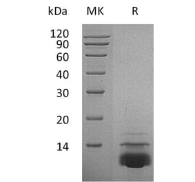 SDS-PAGE - Recombinant Human CXCL5 Protein (A317591) - Antibodies.com
