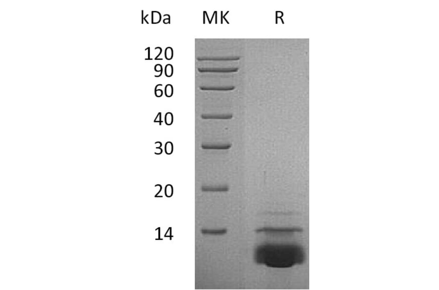 SDS-PAGE - Recombinant Human CXCL5 Protein (A317591) - Antibodies.com