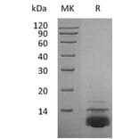 SDS-PAGE - Recombinant Human CXCL5 Protein (A317591) - Antibodies.com