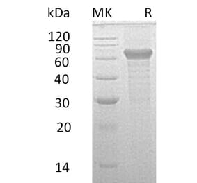 SDS-PAGE - Recombinant Human IL-20R2 Protein (Fc Tag) (A317592) - Antibodies.com