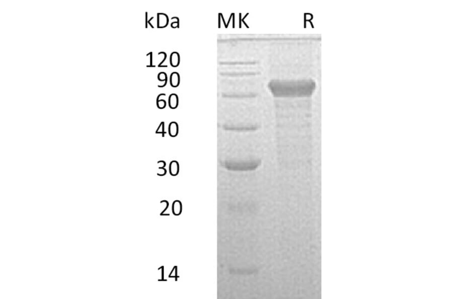 SDS-PAGE - Recombinant Human IL-20R2 Protein (Fc Tag) (A317592) - Antibodies.com