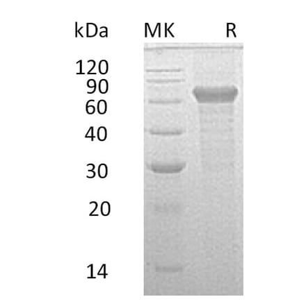 SDS-PAGE - Recombinant Human IL-20R2 Protein (Fc Tag) (A317592) - Antibodies.com