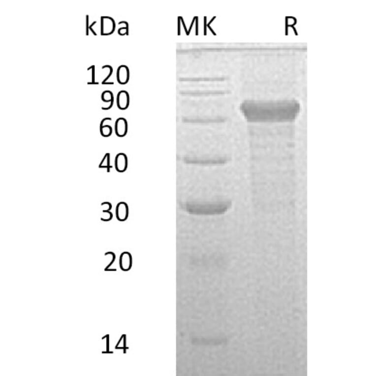SDS-PAGE - Recombinant Human IL-20R2 Protein (Fc Tag) (A317592) - Antibodies.com