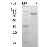 SDS-PAGE - Recombinant Human IL-20R2 Protein (Fc Tag) (A317592) - Antibodies.com