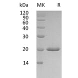 SDS-PAGE - Recombinant Human Interferon alpha 4 Protein (6×His Tag) (A317593) - Antibodies.com