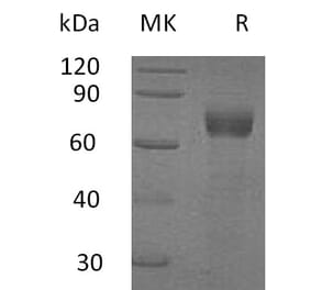 SDS-PAGE - Recombinant Human IL-20R1 Protein (Fc Tag) (A317594) - Antibodies.com