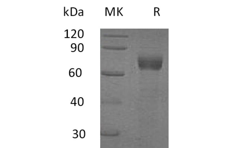 SDS-PAGE - Recombinant Human IL-20R1 Protein (Fc Tag) (A317594) - Antibodies.com
