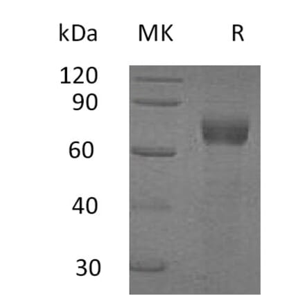 SDS-PAGE - Recombinant Human IL-20R1 Protein (Fc Tag) (A317594) - Antibodies.com