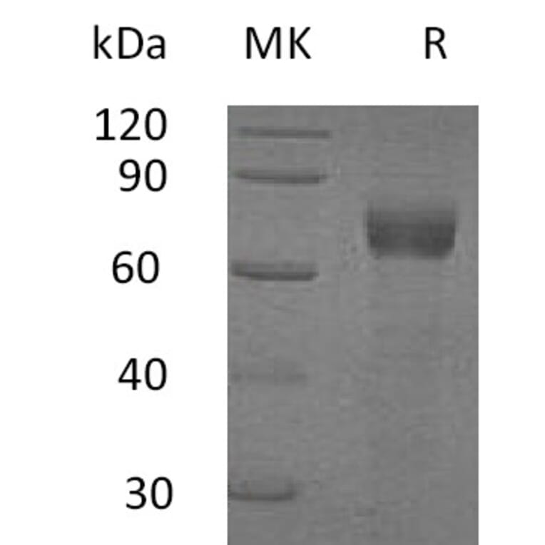 SDS-PAGE - Recombinant Human IL-20R1 Protein (Fc Tag) (A317594) - Antibodies.com