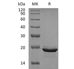 SDS-PAGE - Recombinant Human FGF12 Protein (A317596) - Antibodies.com