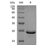 SDS-PAGE - Recombinant Human FGF12 Protein (A317596) - Antibodies.com