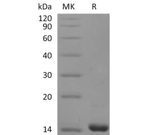 SDS-PAGE - Recombinant Human FGF4 Protein (A317597) - Antibodies.com