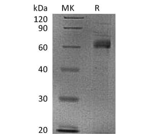 SDS-PAGE - Recombinant Human Noggin Protein (Fc Tag) (A317599) - Antibodies.com