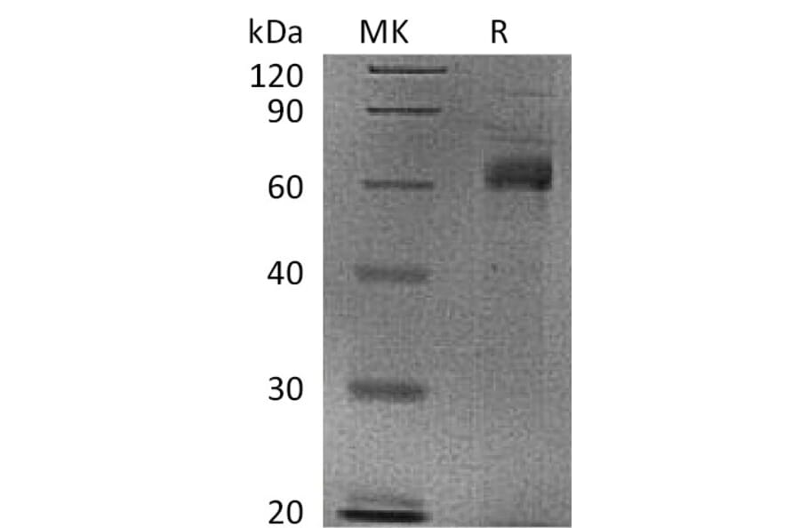 SDS-PAGE - Recombinant Human Noggin Protein (Fc Tag) (A317599) - Antibodies.com