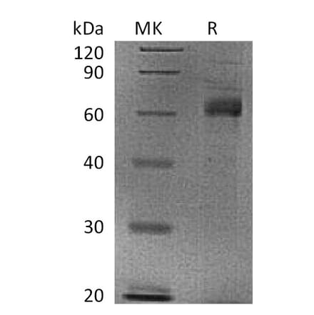 SDS-PAGE - Recombinant Human Noggin Protein (Fc Tag) (A317599) - Antibodies.com