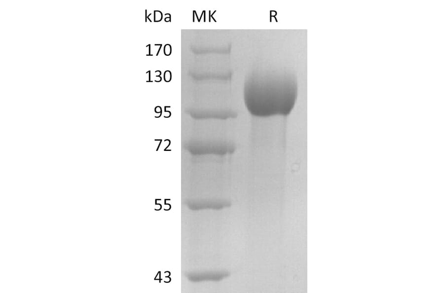 SDS-PAGE - Recombinant Human Estrogen-Induced Gene 121 Protein (6×His Tag) (A317600) - Antibodies.com
