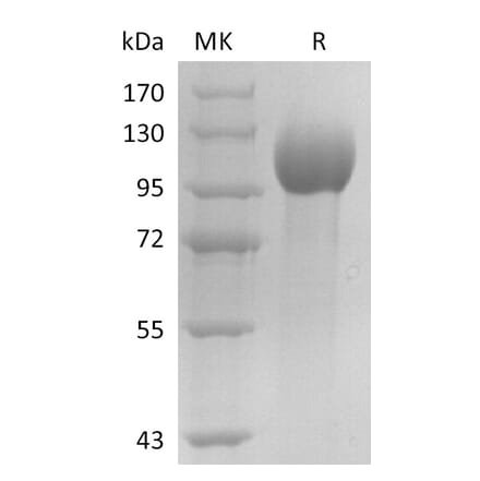 SDS-PAGE - Recombinant Human Estrogen-Induced Gene 121 Protein (6×His Tag) (A317600) - Antibodies.com