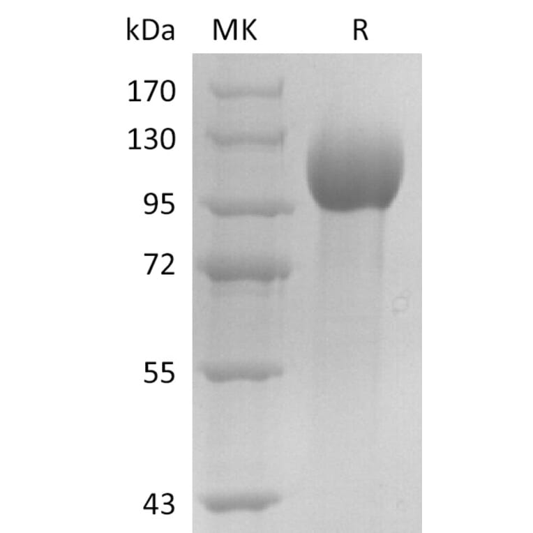 SDS-PAGE - Recombinant Human Estrogen-Induced Gene 121 Protein (6×His Tag) (A317600) - Antibodies.com