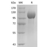 SDS-PAGE - Recombinant Human Estrogen-Induced Gene 121 Protein (6×His Tag) (A317600) - Antibodies.com