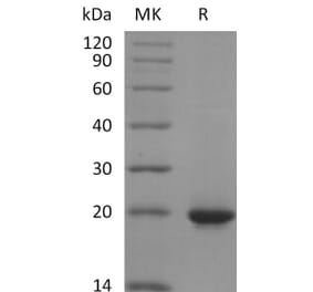 SDS-PAGE - Recombinant Human Sonic Hedgehog Protein (6×His Tag) (A317601) - Antibodies.com