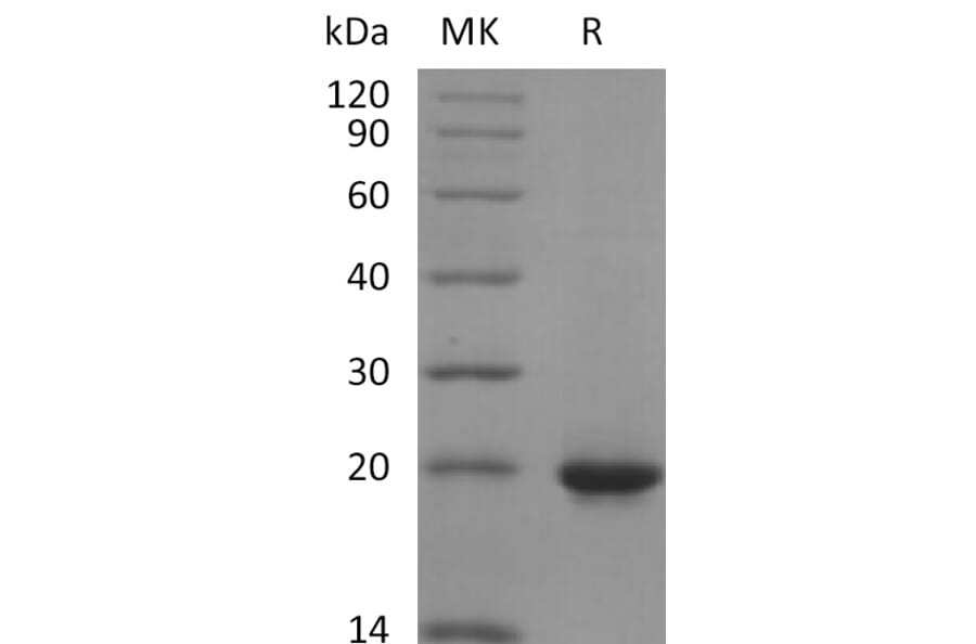 SDS-PAGE - Recombinant Human Sonic Hedgehog Protein (6×His Tag) (A317601) - Antibodies.com