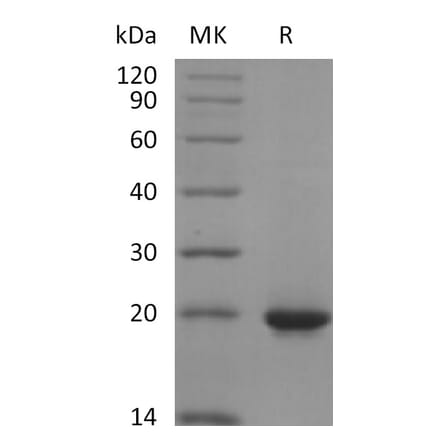 SDS-PAGE - Recombinant Human Sonic Hedgehog Protein (6×His Tag) (A317601) - Antibodies.com