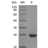 SDS-PAGE - Recombinant Human Sonic Hedgehog Protein (6×His Tag) (A317601) - Antibodies.com