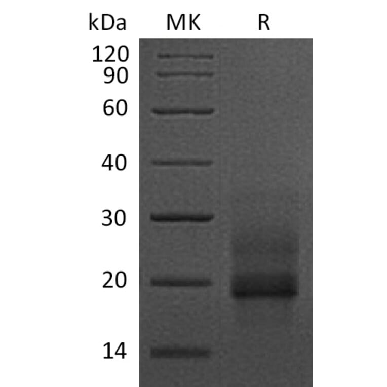SDS-PAGE - Recombinant Human Pro-HBEGF/DTR Protein (6×His Tag) (A317604) - Antibodies.com