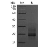 SDS-PAGE - Recombinant Human Pro-HBEGF/DTR Protein (6×His Tag) (A317604) - Antibodies.com