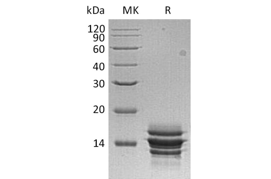 SDS-PAGE - Recombinant Human CXCL7/PBP Protein (6×His Tag) (A317606) - Antibodies.com