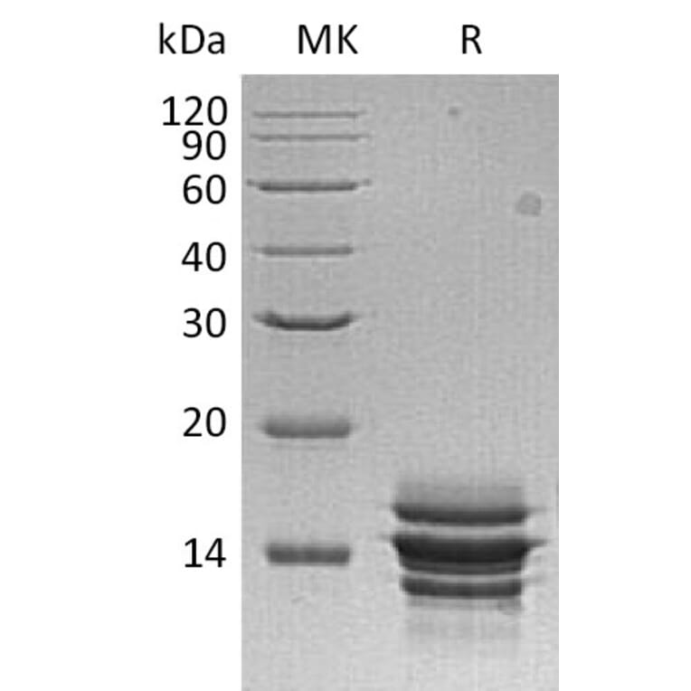 SDS-PAGE - Recombinant Human CXCL7/PBP Protein (6×His Tag) (A317606) - Antibodies.com
