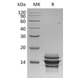 SDS-PAGE - Recombinant Human CXCL7/PBP Protein (6×His Tag) (A317606) - Antibodies.com