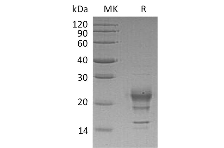 SDS-PAGE - Recombinant Human Interferon gamma Protein (A317607) - Antibodies.com