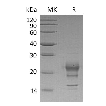 SDS-PAGE - Recombinant Human Interferon gamma Protein (A317607) - Antibodies.com