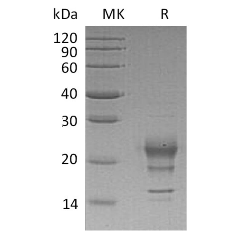SDS-PAGE - Recombinant Human Interferon gamma Protein (A317607) - Antibodies.com