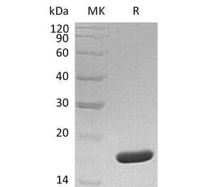 SDS-PAGE - Recombinant Human SF20 Protein (A317611) - Antibodies.com