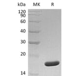 SDS-PAGE - Recombinant Human SF20 Protein (A317611) - Antibodies.com