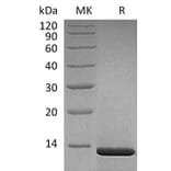 SDS-PAGE - Recombinant Human beta Nerve Growth Factor Protein (A317612) - Antibodies.com