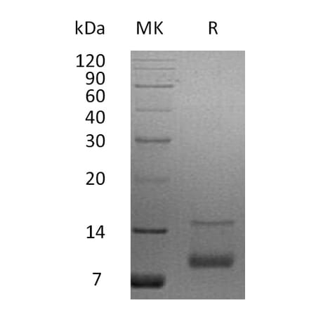 SDS-PAGE - Recombinant Human IGF1 Protein (A317614) - Antibodies.com