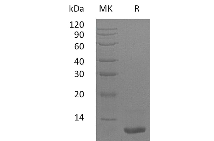 SDS-PAGE - Recombinant Human LR3-IGF1 Protein (A317615) - Antibodies.com