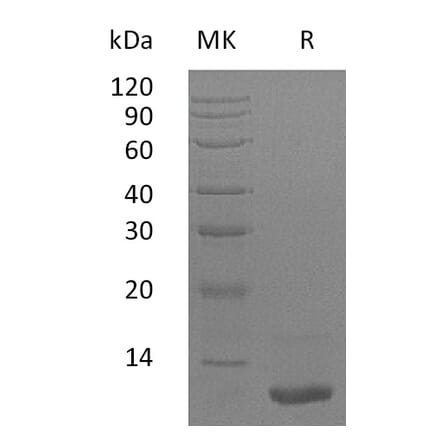 SDS-PAGE - Recombinant Human LR3-IGF1 Protein (A317615) - Antibodies.com