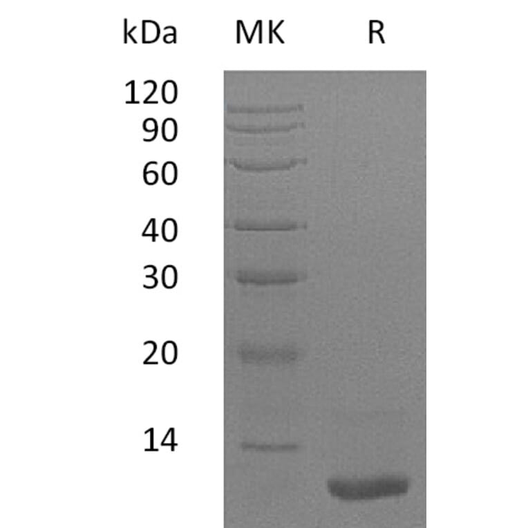 SDS-PAGE - Recombinant Human LR3-IGF1 Protein (A317615) - Antibodies.com
