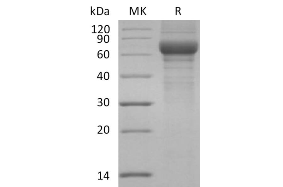 SDS-PAGE - Recombinant Human Vitronectin/S-Protein Protein (6×His Tag) (A317616) - Antibodies.com