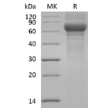 SDS-PAGE - Recombinant Human Vitronectin/S-Protein Protein (6×His Tag) (A317616) - Antibodies.com